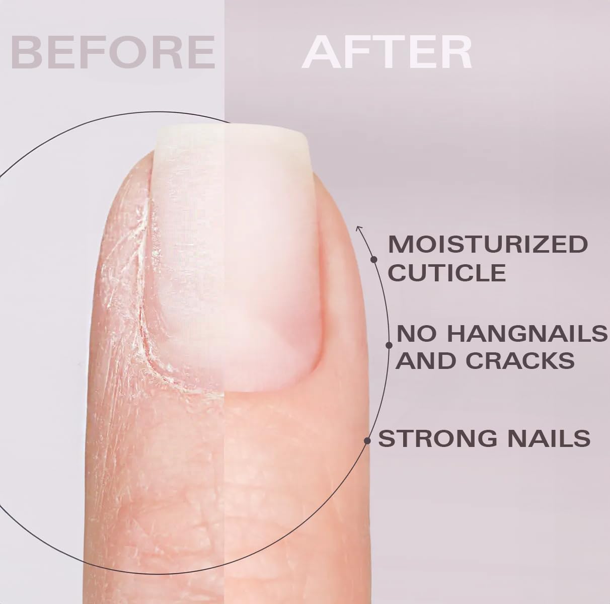 Nail Oil Cuticle Pen - Pineapple - Nail Strengthener & Growth Serum with Vitamin A, D, E, B5, Grapeseed & Natural Oils - Repair for Brittle, Peeling, Thin Nails - Twist Brush Pen