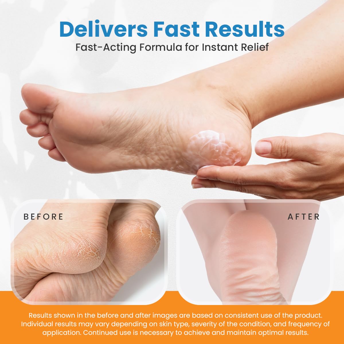 Revitaderm 4D Urea Cream 40% for Feet, Intensive Moisturizing Foot Cream for Dry, Rough, Callused Skin, Includes Free Pumice Stone and Exfoliating Brush, Fast-Absorbing, Fragrance-Free, 4oz, 2 Pack