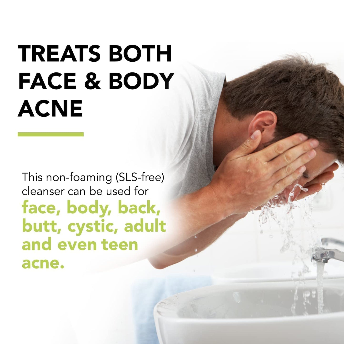 humane Benzoyl Peroxide Acne Body Wash - 10% Maximum-Strength Face, Skin, Butt, and Back Acne Treatment - 16 Fl Oz - Dermatologist-Tested Non-Foaming Acne Face Wash Cleanser - Vegan, Cruelty-Free