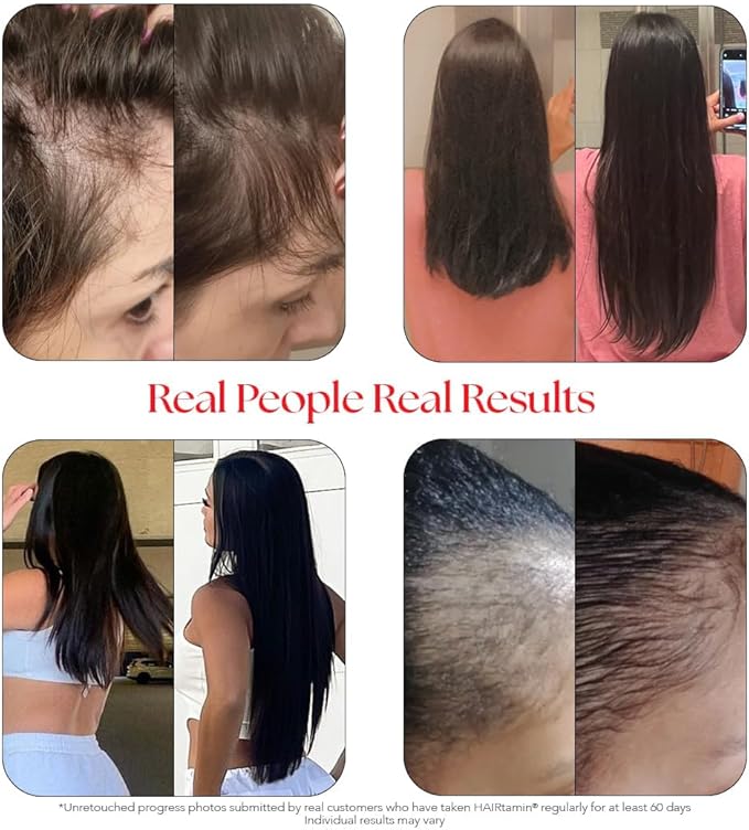 HAIRtamin Vegan Gummy Stars Hair Vitamins | Non-GMO | Natural Biotin Hair Vitamin Gummies to Maintain Healthy Hair Skin & Nails | Multivitamin Supplement to Help Maintain Healthy Looking Hair (3-Pack)