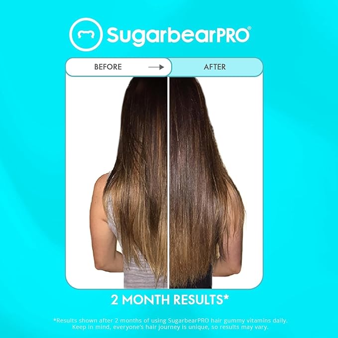 Sugarbear Hair Vitamin Gummy 2 Month Supply & 2 Pure Batana Natural Hair Growth Oil-Extra Strength Biotin 6000mcg, Women, Men, Vegan Vitamin B12, MSM, Inositol, Elderberry, Kosher, Halal, Cruelty-Free