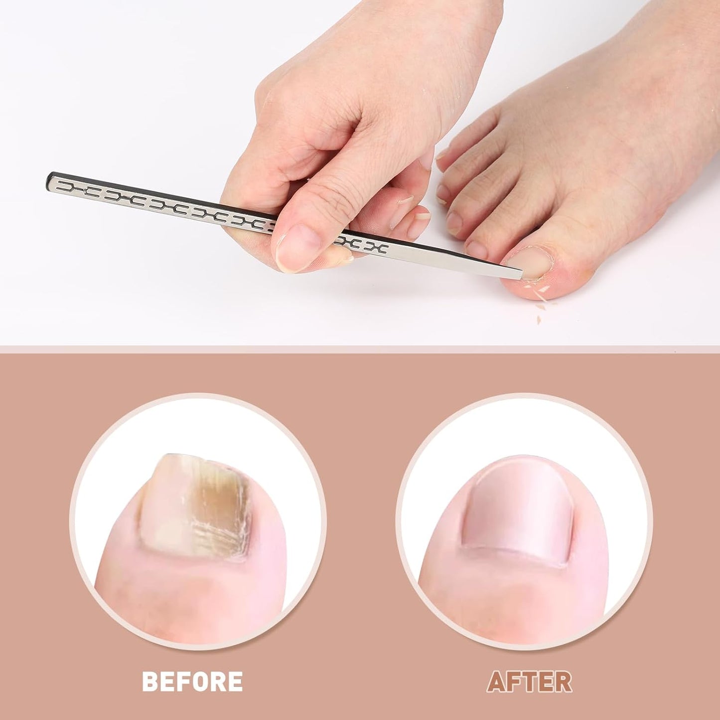 Stainless Steel Ingrown Toenail Pedicure Knife Set,Professional Foot Skin Scraper Repair Sharp Blade Kit For Nail Corn Callus Paronychia Treatment. (5)