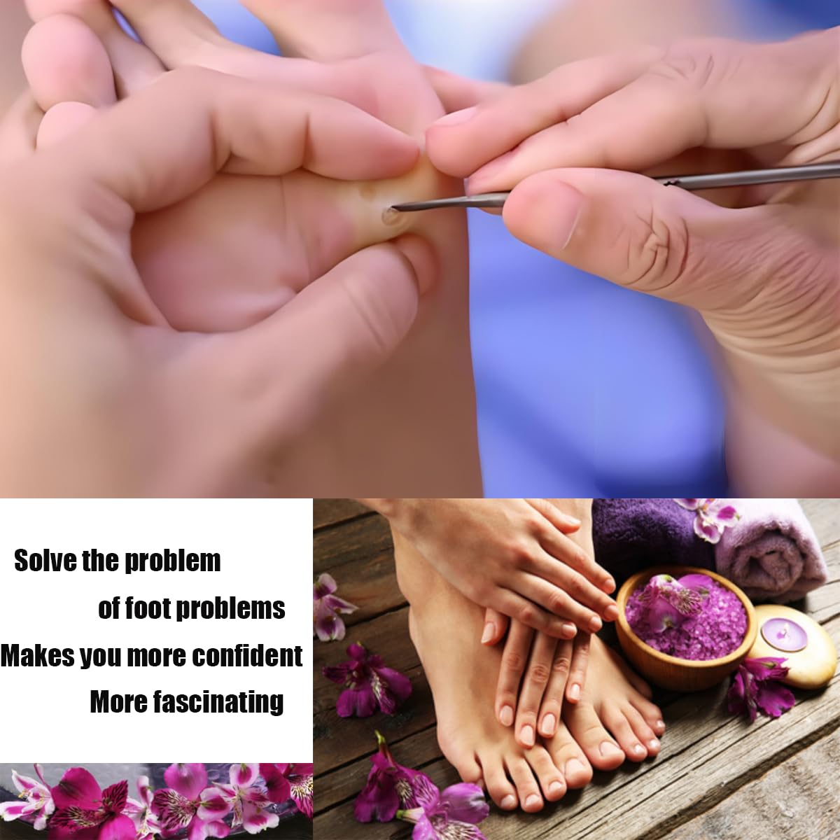 Stainless steel ingrown toenail pedicure knife set,professional foot skin scraper repair sharp blade kit for nail corn callus paronychia treatment. (4)