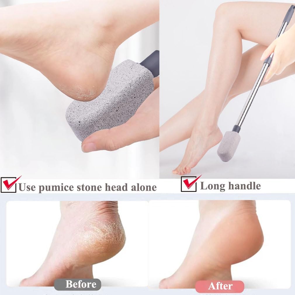 Pumice Stone for Feet, Foot Dead Skin Scrubber with 30" Long Handle Set, Feet File Callus Remover for Exfoliation, Foot Scrub Shower Pedicure Tools Foot Care Stone