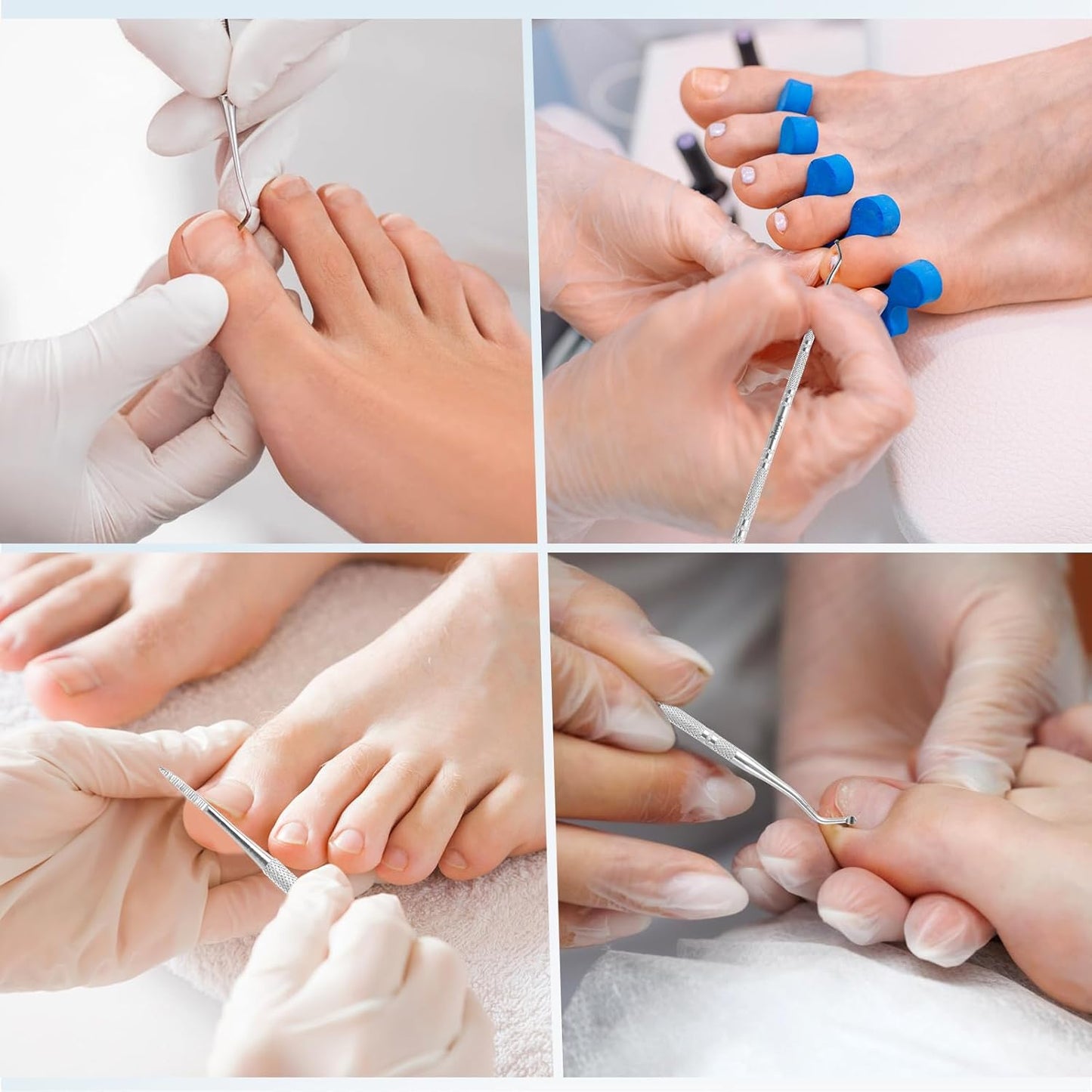 6PCS Ingrown Toenail File and Lifters,Professional Surgical Stainless Steel Ingrown Toenail Tool- Safe Nail Cleaning Treatment Pedicure Tools Kit Under Sidewall Cleaner Pain Relief Accessories