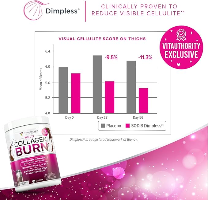 Vitauthority Collagen Peptides Powder Weight Loss | Collagen Supplements Hydrolyzed Beauty Complex | Multi Collagen for Women, Hair Skin Nails | Fat Burning Support | Chocolate Flavored 25 Servings