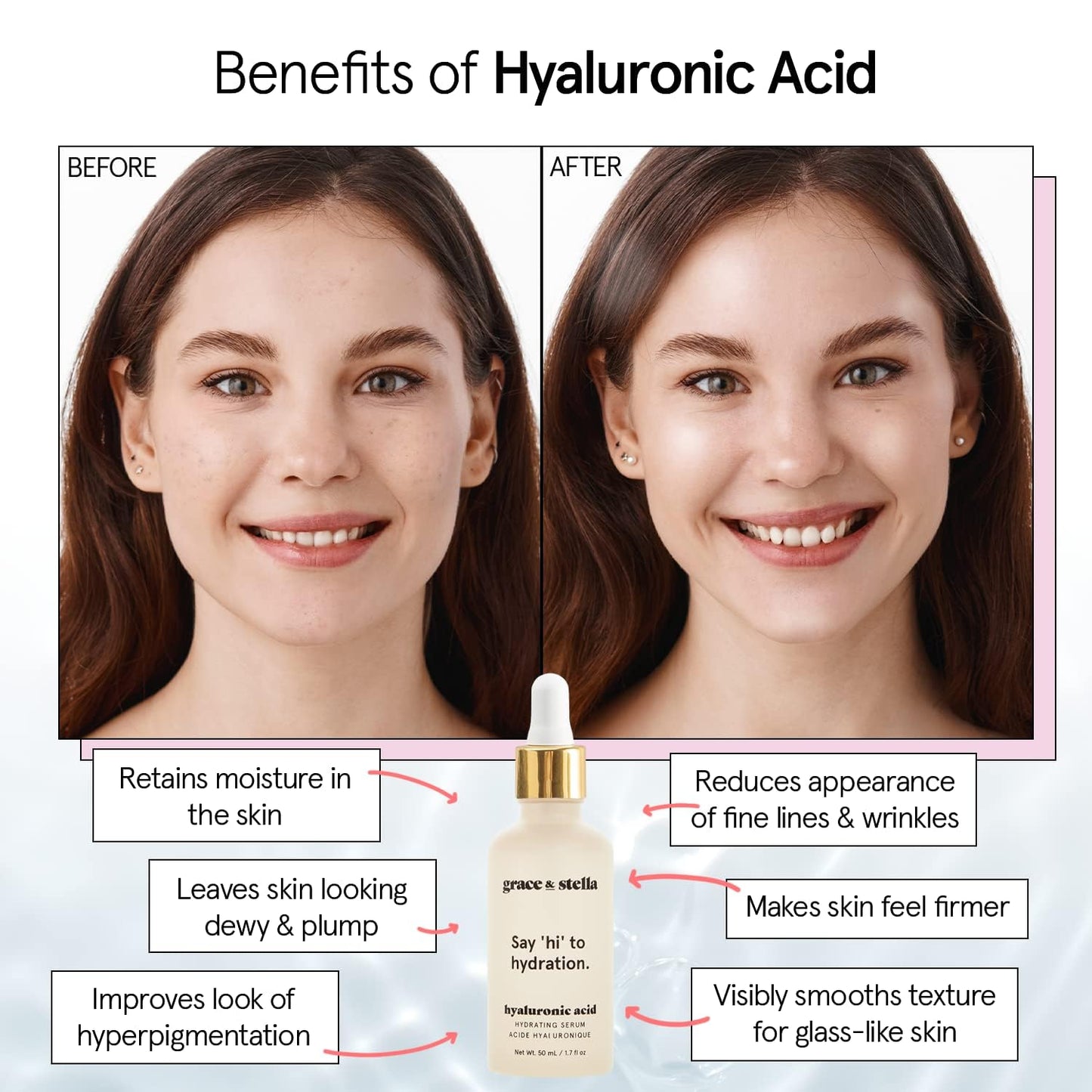 grace & stella Award Winning Hyaluronic Acid Serum (10ml/0.34 fl oz) Hyaluronic Acid Serum for Face - Acido Hialuronico Face Serums for Women - Hydrating, Remove Fine Lines, Wrinkles - Anti Aging