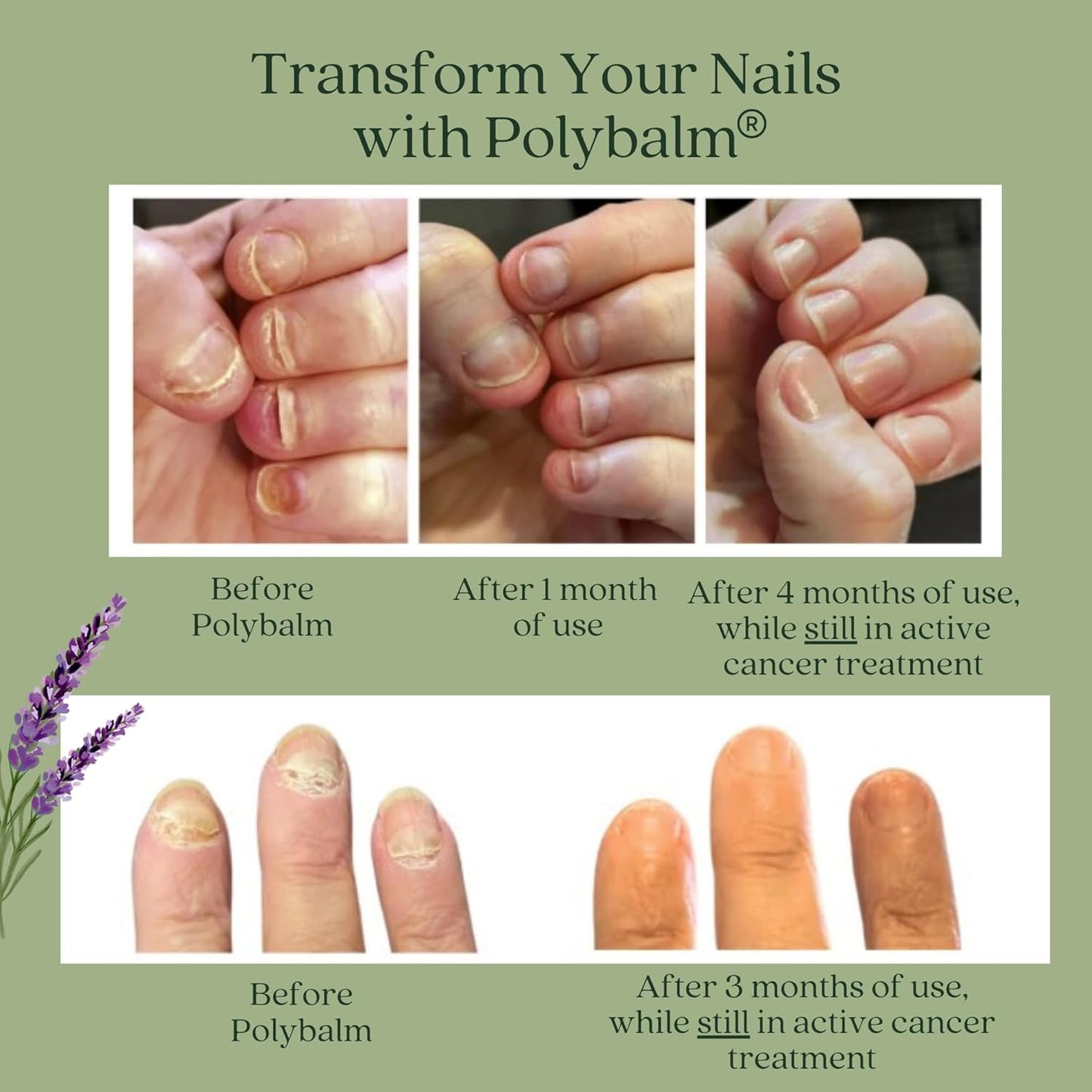 – CLINICALLY PROVEN Nail Protection | 100% NATURAL | Doctor Developed | Strengthen & Repair Nails Damaged by Chemo, Manicures & Aging | Antioxidant, Anti-Fungal & Anti-Inflammatory Properties