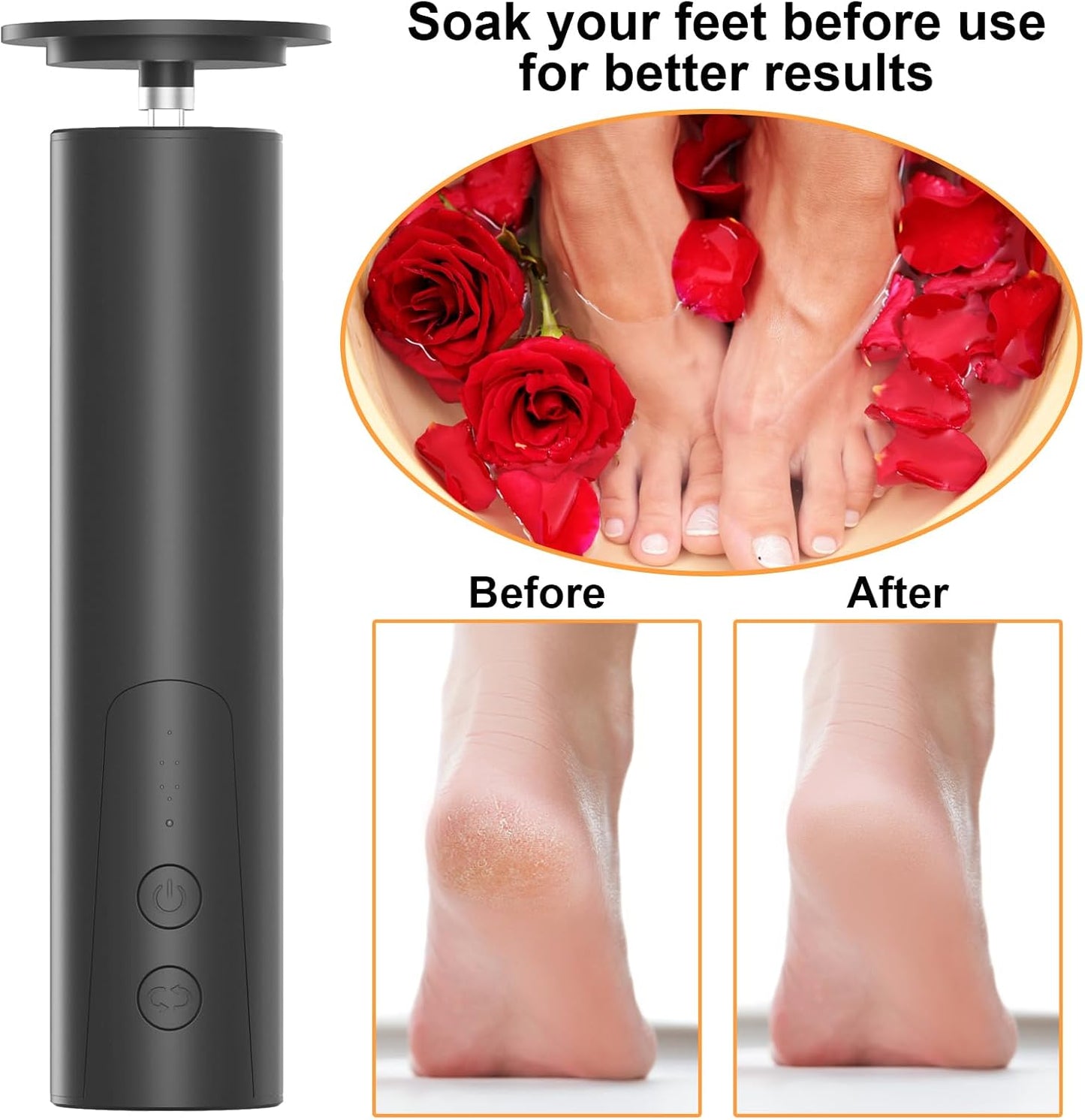 ele ELEOPTION Electric Callus Remover for Feet Electric Foot File Nail Grinder 6 Speed Adjustable Rechargeable Professional Foot Sander Pedicure Tool for Feet Dry Dead Skin Black