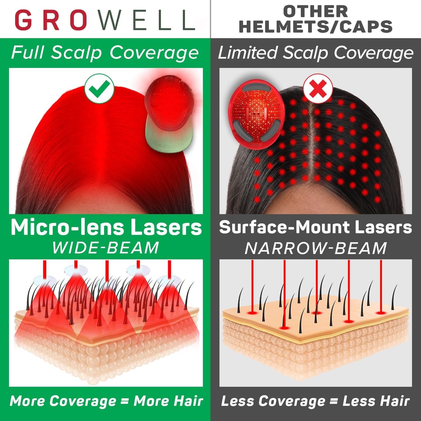 GroWell Red Light Therapy Hair Growth Cap – FDA Cleared Laser Treatment for Hair Regrowth and Reduced Shedding – LED & Laser Red Light Therapy Clinically Proven in Double-Blind Studies -Beige