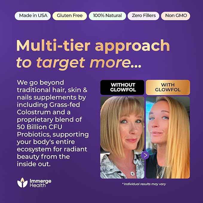 Biotin Collagen Supplement with Probiotics, Colostrum, Hyaluronic Acid and Keratin for Faster Hair Growth | Hair Skin Nails Vitamins For Women and Men | Biotin Hair Growth Supplement | 60 Capsules