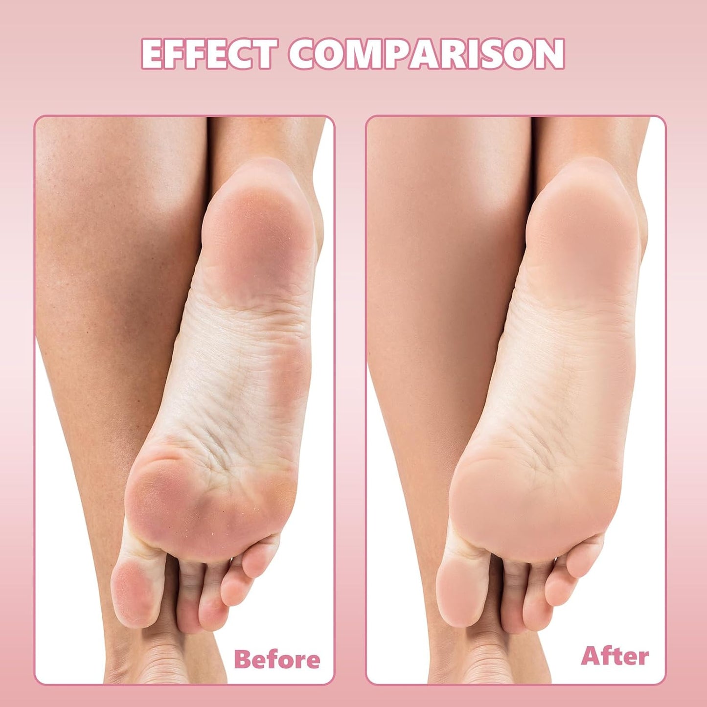 Flutesan 80 Pcs Stainless Steel Foot File Refills 80 Grit Replacement Pads Coarse Fine Pedicure File Refills Double Side Reusable Foot Rasp Pad with Removable Glue