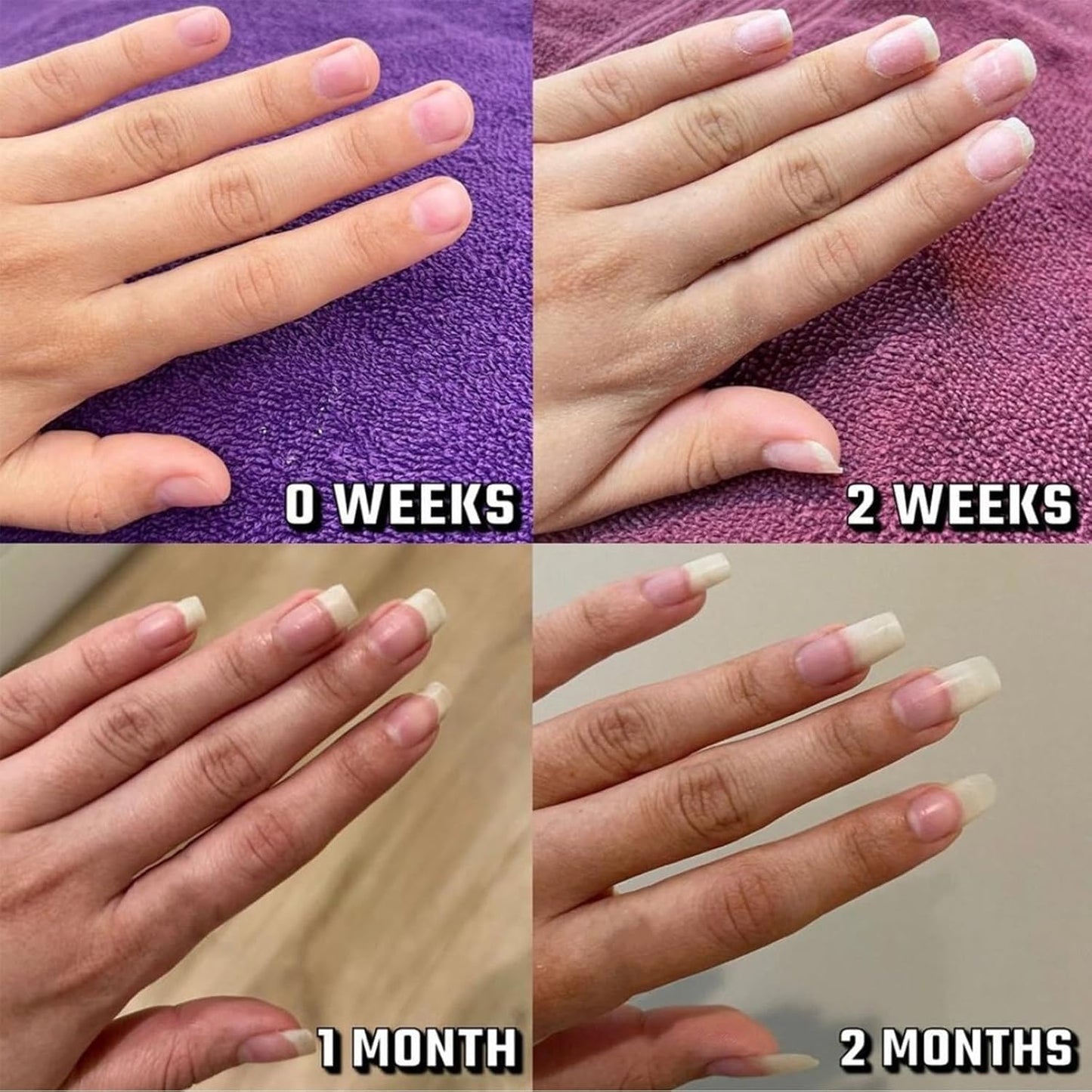 Shana Paris Nail 𝐆𝐫𝐨𝐰𝐭𝐡 Oil, Radiant Nail 𝐆𝐫𝐨𝐰𝐭𝐡 Oil Pen for Moisturize Strengthen Nails Care, Cuticle Oil for Nails Finger Edge Manicure Nourishing (3pcs, 2ml)