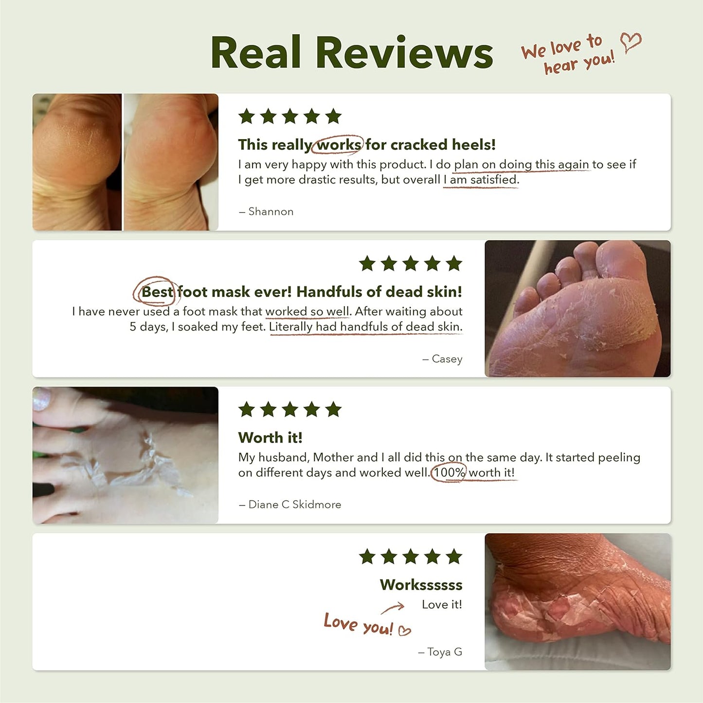 Purederm Shiny & Soft Foot Peeling Mask (6 pack) - For smooth and moist baby skin with Exfoliating peel off Calluses, Dry Skin, Cracked Heels - Men and Women