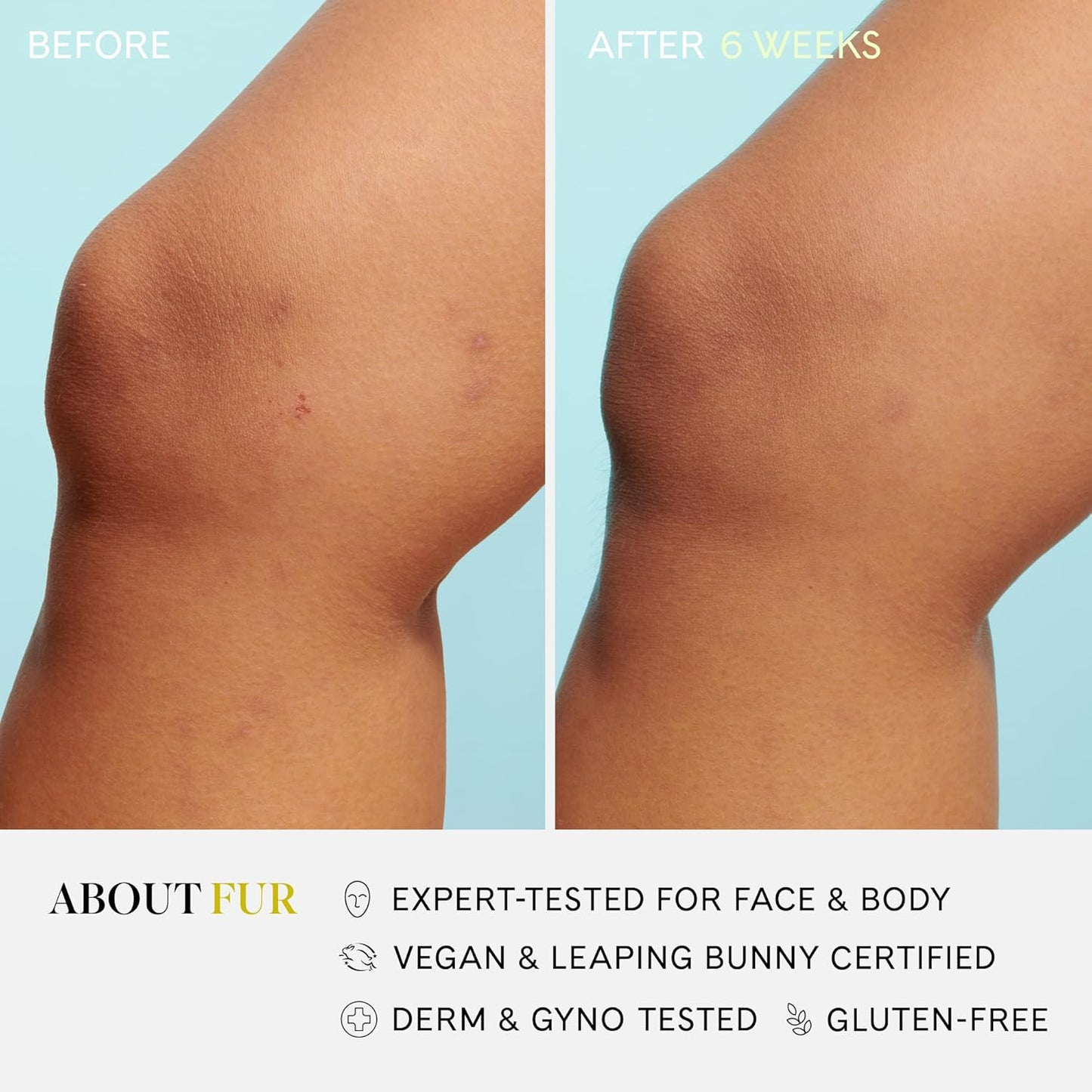 Fur Silk Scrub: Premium KP Bump Eraser - Powerful Exfoliating & Resurfacing Scrub to Smooth and Hydrate Skin While Preventing Ingrown Hairs with Natural Oils and AHAs - 6 Fl oz.