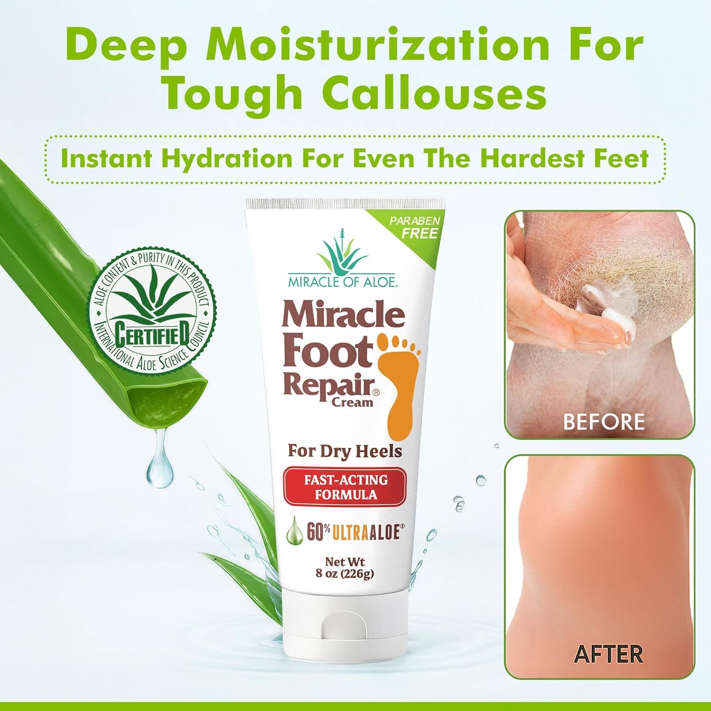 Miracle Foot Repair Cream (8 oz & 1 oz) Repairs Dry Cracked Heels and Feet, 60% Pure UltraAloe Moisturizes, Softens, and Repairs